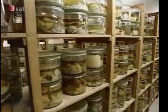 Murdered Children's Brains for Research